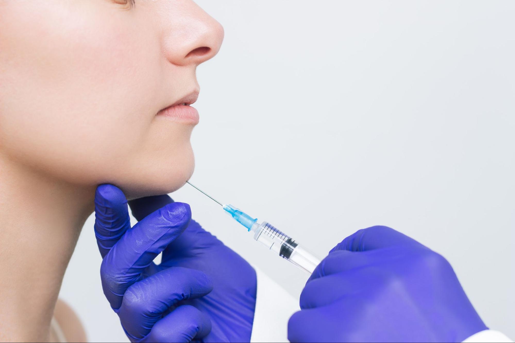 ฟิลเลอร์คาง