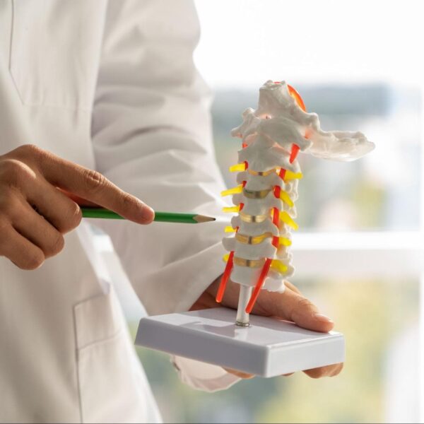 Spondylosis